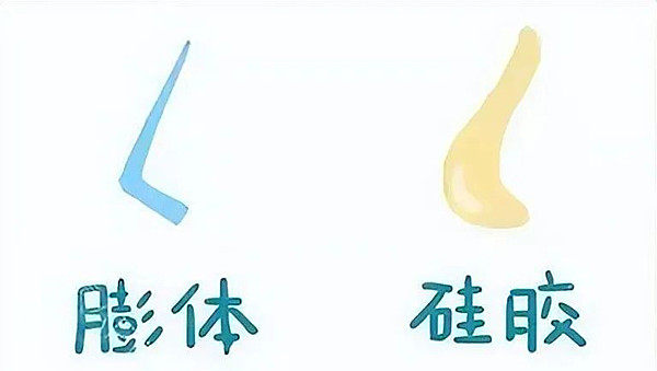 膨体隆鼻