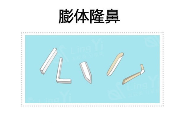膨体隆鼻