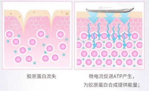 热拉提和热玛吉哪个副作用小