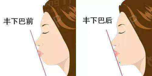 前后对比