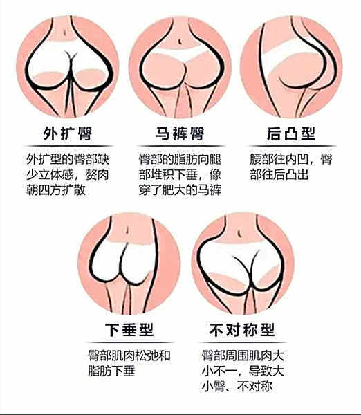 臀部形状