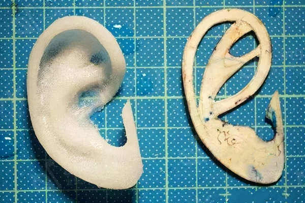 小耳畸形整形手术过程及价格