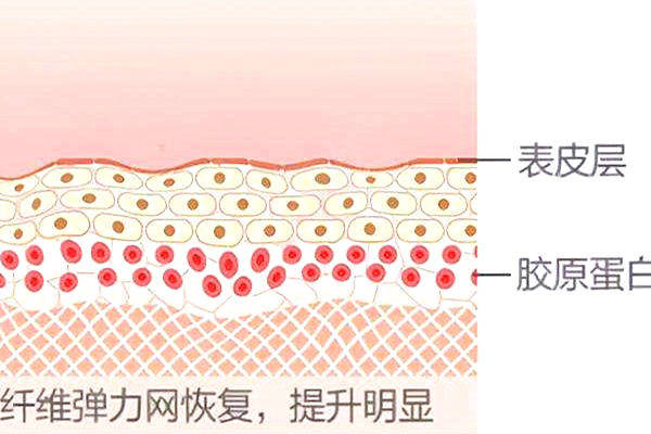 热玛吉四代和五代的区别是什么