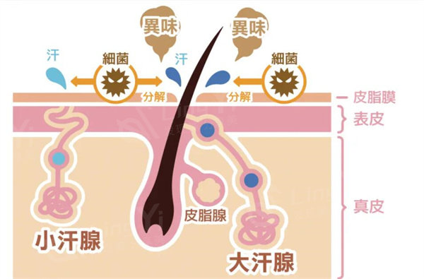 狐臭手术