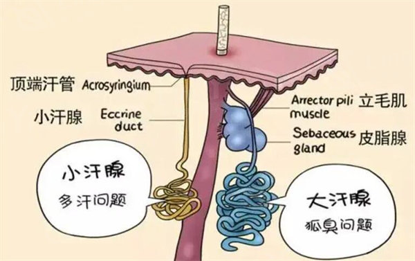 去除狐臭