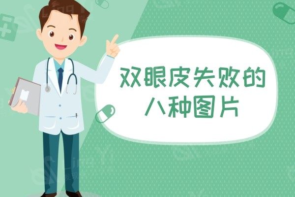 双眼皮失败的八种图片，都可作为双眼失败鉴定标准成效图