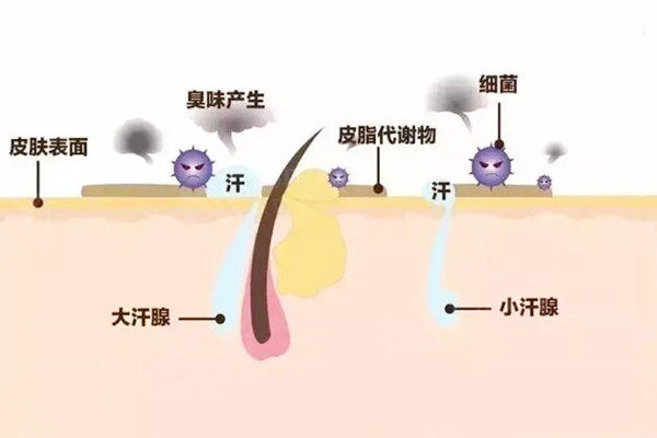 腋臭产生的原因