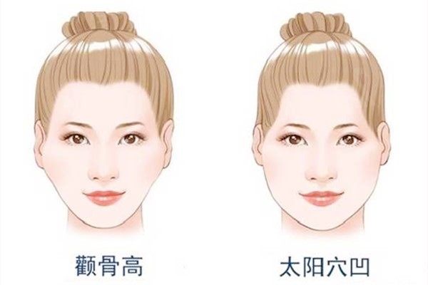 颧骨高的人瘦下来更难看