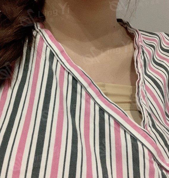 隆胸手术一周