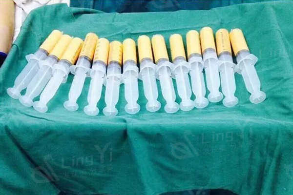 戴牙套从瓜子脸变方脸怎么办