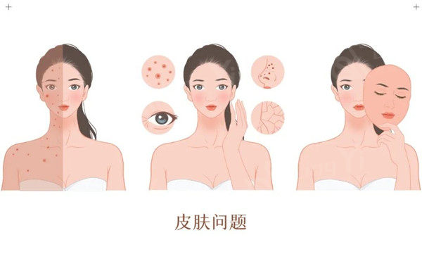 皮肤问题