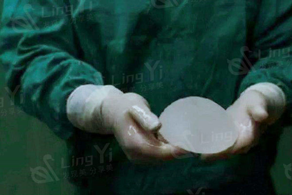 假体隆胸取出的同时可以换新假体吗