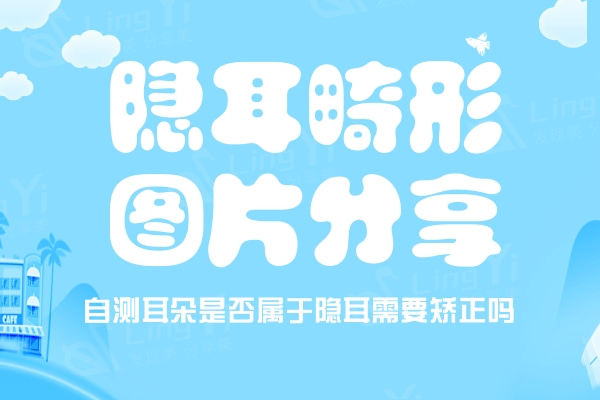 隐耳畸形图片分享，自测耳朵是否属于隐耳需要矫正吗