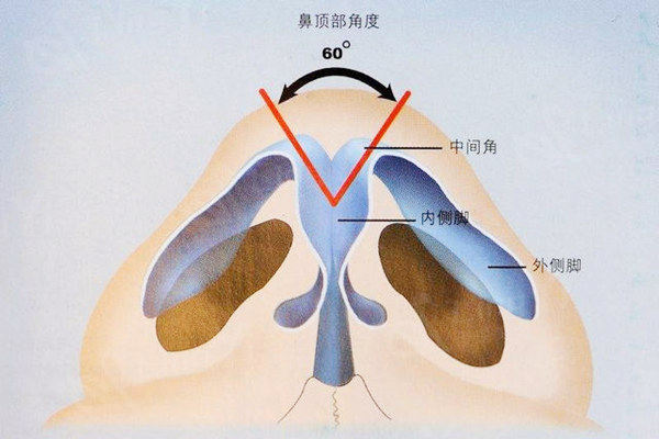 隆鼻不满意可以免费修复吗