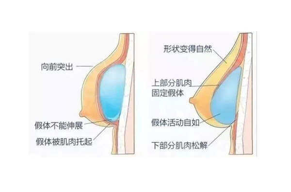 胸部示意图