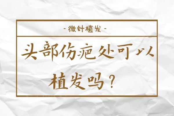 头皮伤疤可以植发吗?头皮缝针/烧伤等有疤痕的地方能种植头发吗?