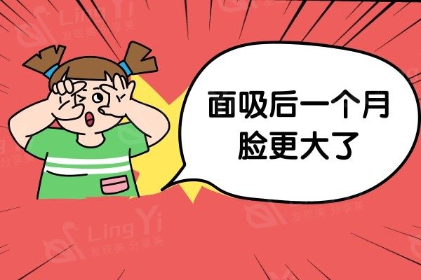 面吸后一个月脸更大了原因谁知道？面部吸脂多久脸最瘦