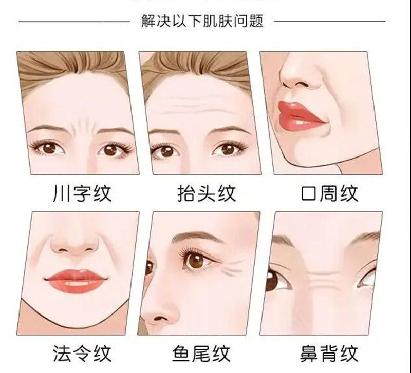去皱针停了会变老吗？