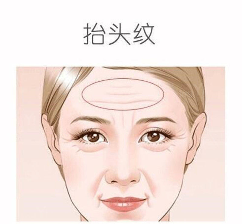 抬头纹