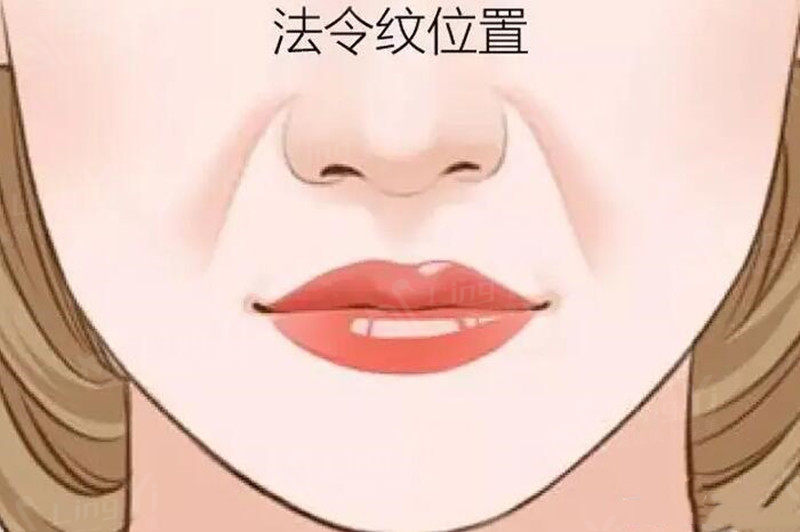 法令纹