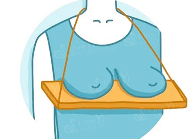 人工韧带乳房提升术和悬吊术区别是啥?胸太软了下垂严重怎么办?