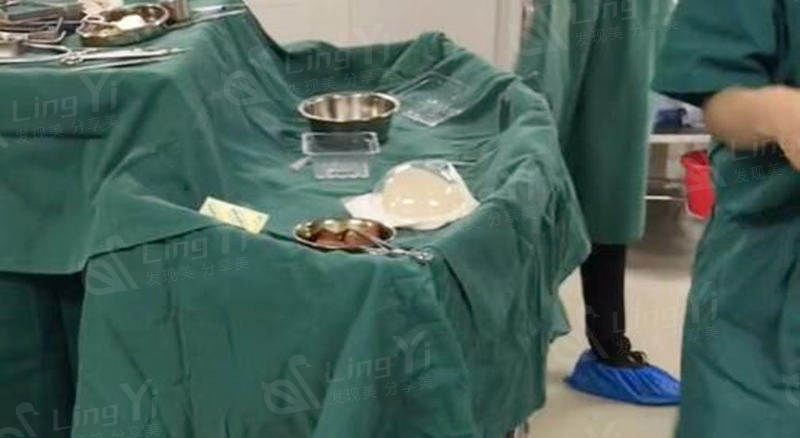傲诺拉璀璨215做出来多大