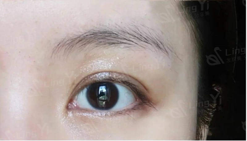 每个年龄段眼睛护理的方法