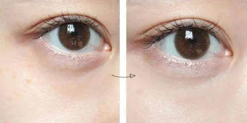 每个年龄段眼睛护理的方法