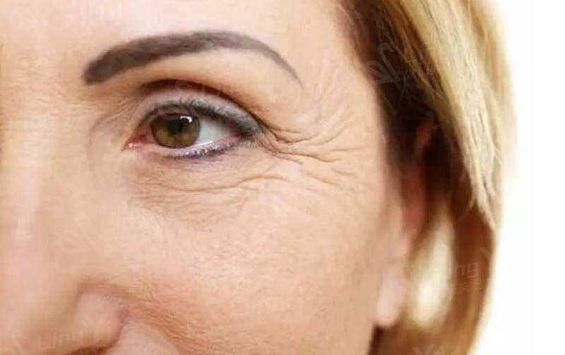 每个年龄段眼睛护理的方法