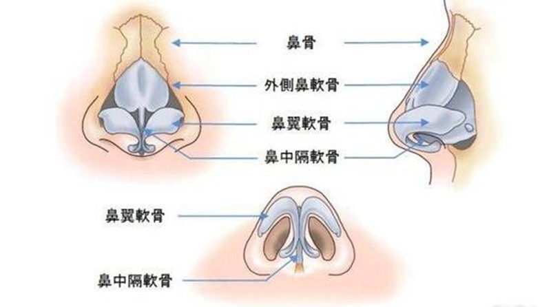 鼻骨内推