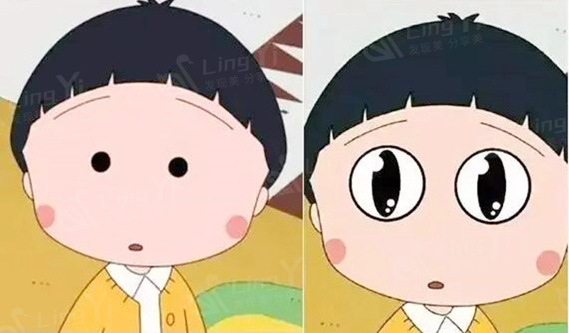 男子嫌单眼皮丑43岁割双眼皮,术后恢复期被照顾的像在坐月子-整形资讯