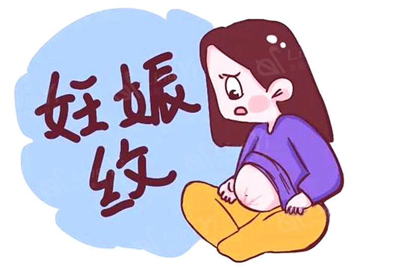 妊娠纹可以激光去掉吗