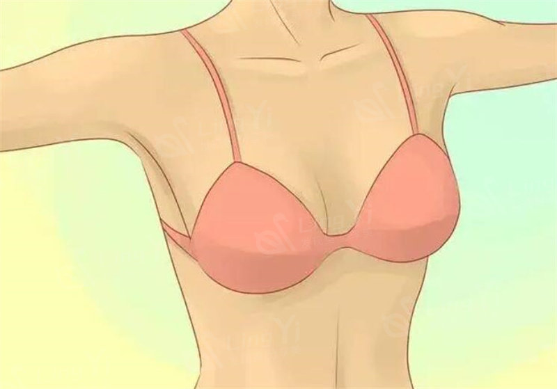 内衣真的可以调整胸型吗？比如说外扩、下垂、收副乳的情况