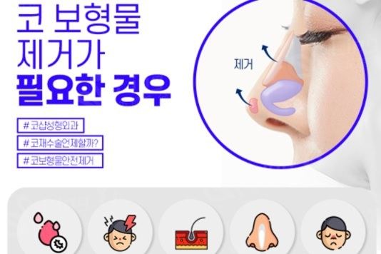 苹果肌不饱满,下巴不漂亮,可能是你没体验过韩国鼻综合整形手术