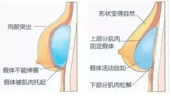 韩国MD整形外科