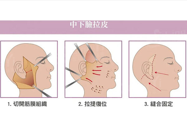 韩国拉皮手术好的医院位置在哪？必妩/BIO/菲斯莱茵地址公布