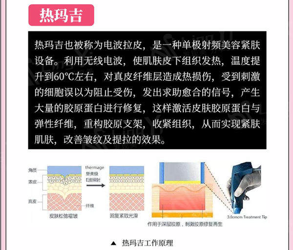 热玛吉原理