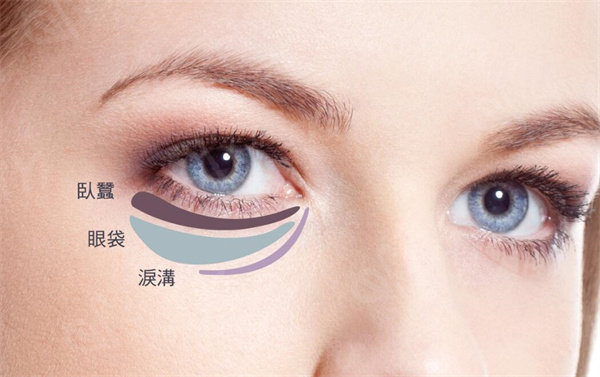 眼袋