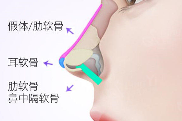 鼻部整形结构