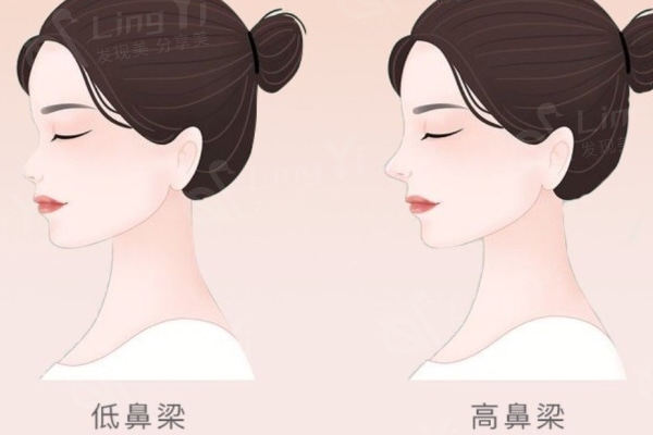 韩国gng鼻修复医生推荐