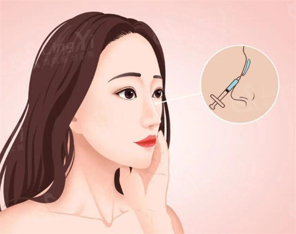 隆鼻真人感受