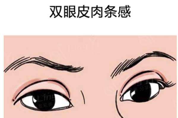 韩国世美整形各项价格：修复肉条+单只修复的价格曝光