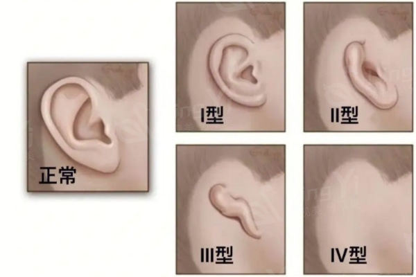 国内做耳畸形矫正出名的医生有哪些?推荐排名前五的郭树忠/赵绛波等医生