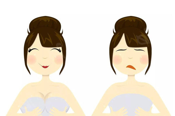 假体隆胸
