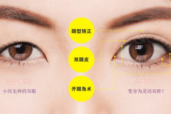 眼综合