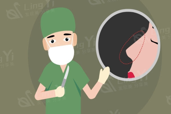 武汉艺星做鼻子怎么样？武汉艺星肋骨鼻综合做得好价格还不贵