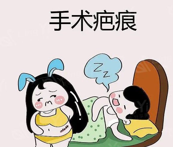 上海建桥疤痕修复中心费用高吗
