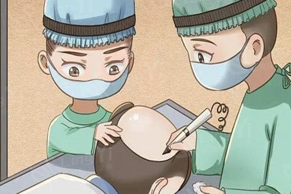 沈阳华美植发是正规医院吗？是正规医院且植发技术实力强