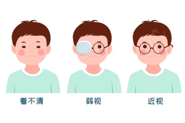 杭州爱尔眼科医院是几级医院，是三级正规专科眼科医院且治疗近视好