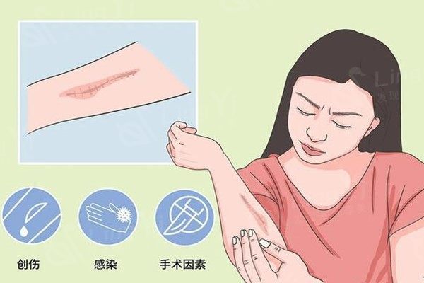 宋红霞医生怎么样？听说增生疤痕、烧烫伤疤痕、手术疤痕她的技术蛮好的